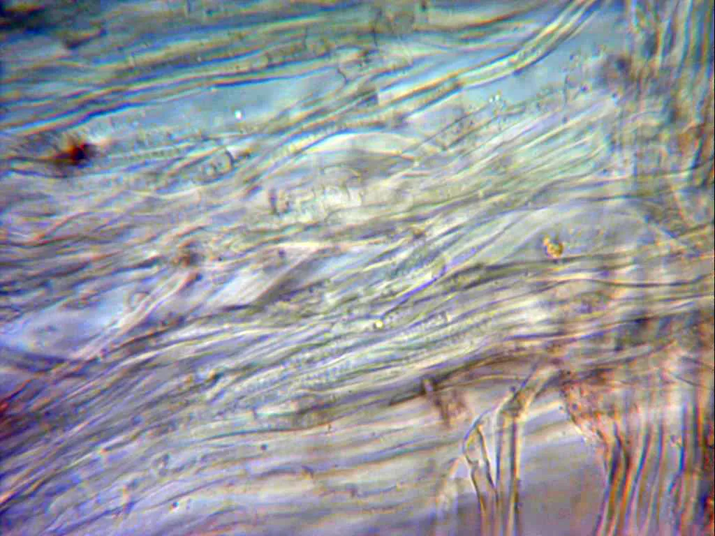 Microscopía de Pterulicium gracile - 10 - Hifas septadas